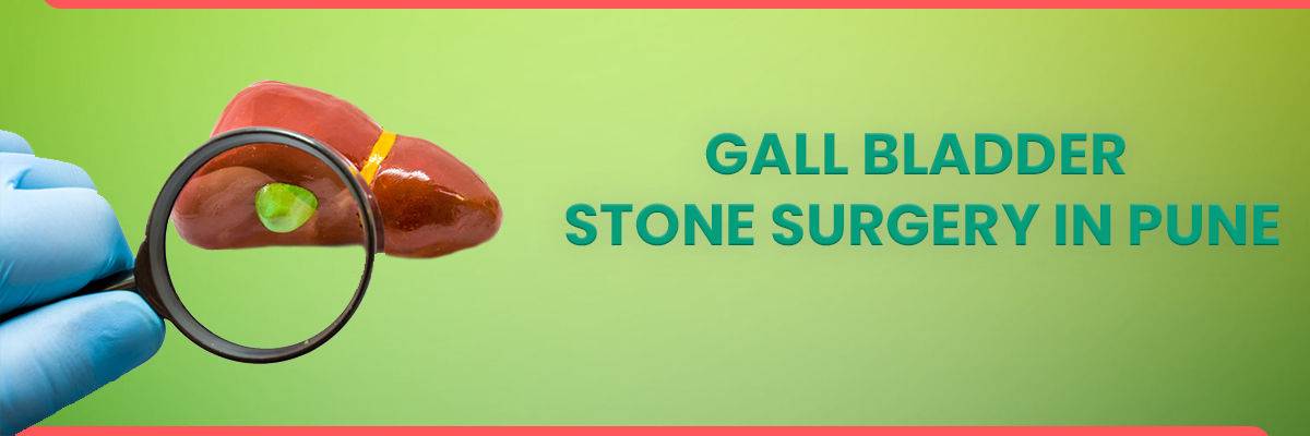 Gallbladder Stone Surgery