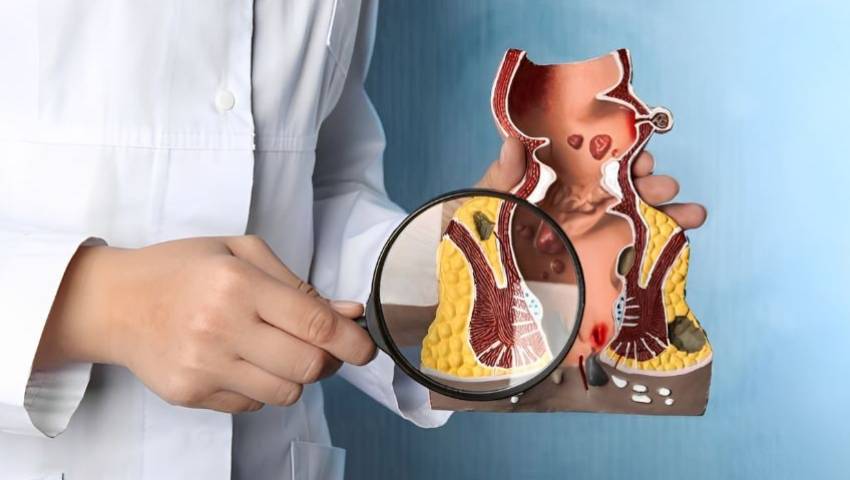 Fistula Recurrence