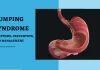 Understanding dumping syndrome: symptoms, prevention, and management