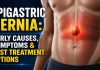 Advanced Epigastric Hernia treatment in Pune by Dr. Samrat Jankar for safe and effective hernia care