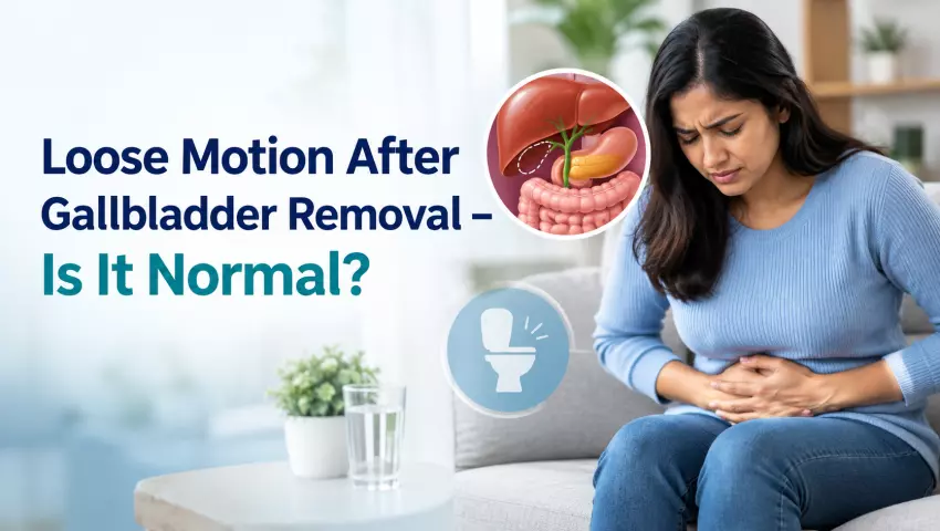 Loose Motion After Gallbladder Removal: Causes and Digestive Changes